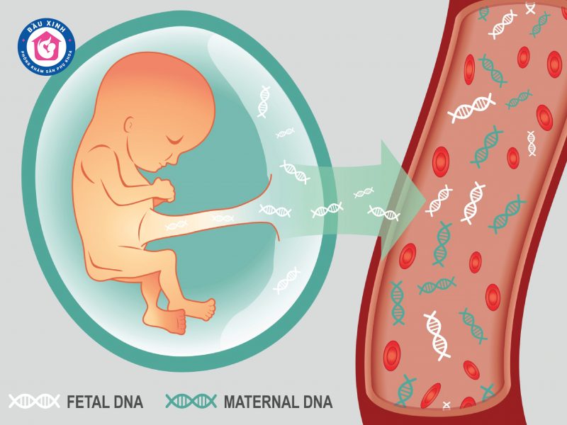 Kết quả xét nghiệm NIPT khi được kết hợp với kết quả siêu âm lâm sàng sẽ giúp bác sĩ phát hiện sớm các nguy cơ dị tật ở thai nhi