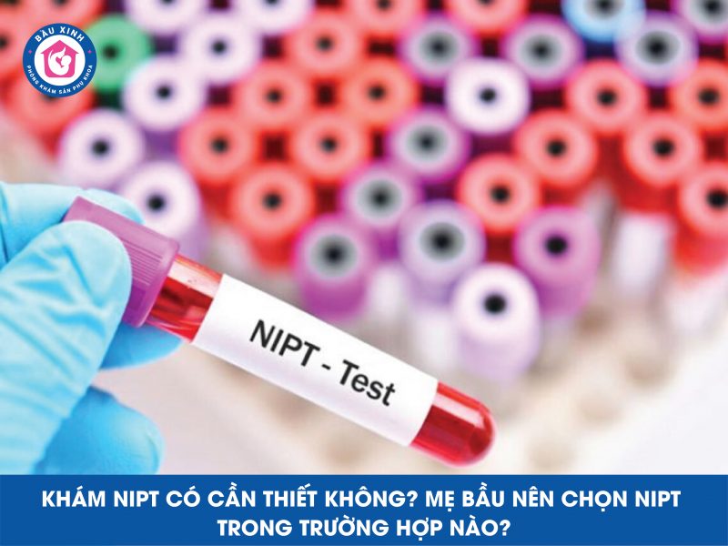 Khám NIPT Có Cần Thiết Không? Mẹ Bầu Nên Chọn Nipt Trong Trường Hợp Nào?